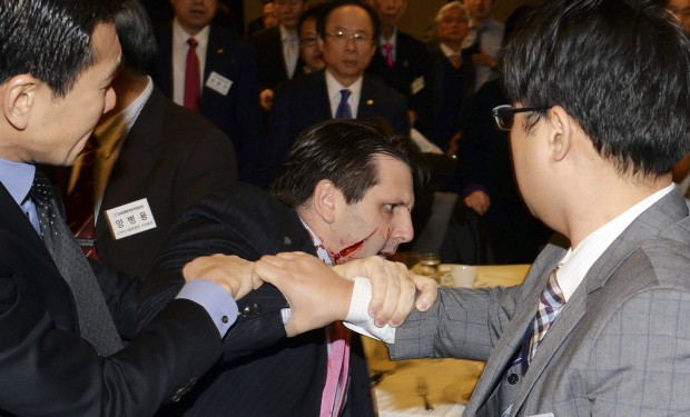 US ambassador slashed on face in South Korea